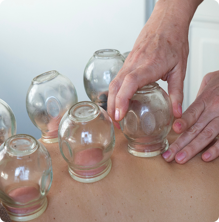 Ilse Bink voert transformational cupping uit op de rug van een klant in haar praktijk Beauty by Balance in Roosendaal.